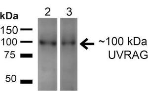Western blot analysis of Human HeLa and 293T cell lysates showing detection of ~100kDa UVRAG protein using Rabbit Anti-UVRAG Polyclonal Antibody . (UVRAG Antikörper  (Atto 488))