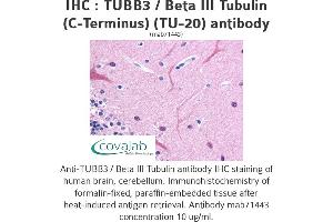 Image no. 3 for anti-Tubulin, beta 3 (TUBB3) (N-Term) antibody (ABIN1724161) (TUBB3 Antikörper  (N-Term))