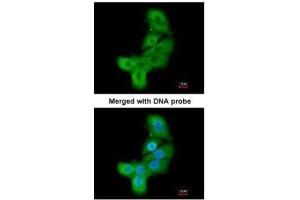 ICC/IF Image Immunofluorescence analysis of paraformaldehyde-fixed A549, using LIM kinase 2, antibody at 1:200 dilution. (LIMK2 Antikörper)