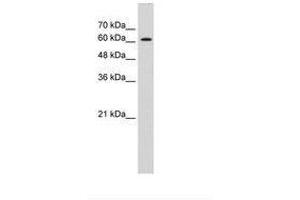 Image no. 2 for anti-ZIC2 (ZIC2) (AA 446-495) antibody (ABIN6736299) (ZIC2 Antikörper  (AA 446-495))