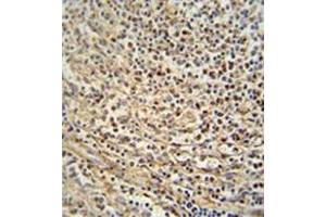 Immunohistochemistry analysis in formalin fixed and paraffin embedded human spleen tissue reacted with Gasdermin C Antibody (Center) followed by peroxidase conjugation of the secondary antibody and DAB staining. (MLZE Antikörper  (Middle Region))