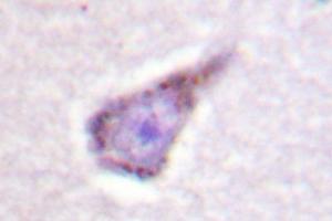 Image no. 2 for anti-Wiskott-Aldrich Syndrome (Eczema-thrombocytopenia) (WAS) antibody (ABIN272092) (WASP Antikörper)