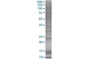 EXOSC1 transfected lysate (EXOSC1 293T Cell Transient Overexpression Lysate(Denatured))