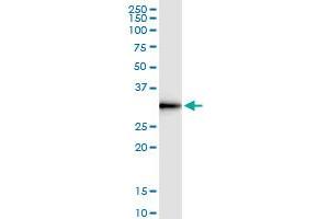 Immunoprecipitation of DNALI1 transfected lysate using rabbit polyclonal anti-DNALI1 and Protein A Magnetic Bead (DNALI1 (Human) IP-WB Antibody Pair)