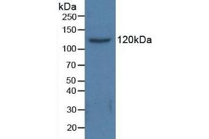 Figure. (HDAC6 Antikörper  (AA 166-348))