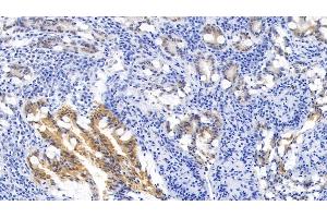 Detection of KRT6A in Human Small intestine Tissue using Monoclonal Antibody to Keratin 6A (KRT6A) (KRT6A Antikörper  (AA 163-468))