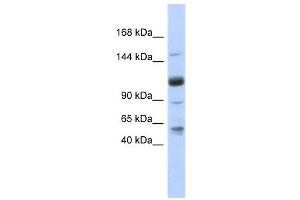 SR140 antibody used at 1 ug/ml to detect target protein. (SR140 Antikörper  (N-Term))