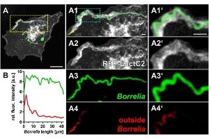 (A) Immunofluorescence micrographs of a primary macrophage expressing RFP–LactC2 (white), with internalized wild-type borreliae, stained by outside staining technique using Borrelia-specific antibody for antibody-accessible spirochetes (red), followed by permeabilization and staining of entire Borrelia cells. (Borrelia Burgdorferi Antikörper)