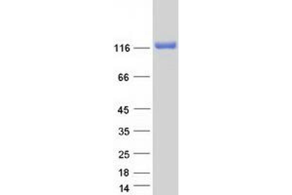 NOMO2 Protein (Transcript Variant 2) (Myc-DYKDDDDK Tag)