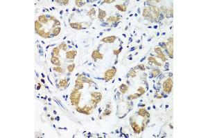 Immunohistochemistry of paraffin-embedded human stomach using OXCT1 antibody (ABIN5974499) at dilution of 1/100 (40x lens). (OXCT1 Antikörper)