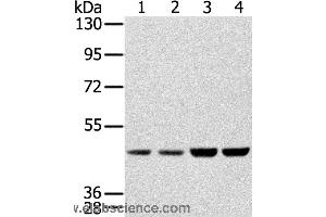 Western blot analysis of Hela, Raji, 231 and K562 cell, using SSB Polyclonal Antibody at dilution of 1:400 (SSB Antikörper)