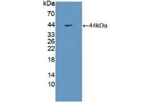 Detection of Recombinant GHR, Human using Polyclonal Antibody to Growth Hormone Receptor (GHR) (Growth Hormone Receptor Antikörper  (AA 315-574))