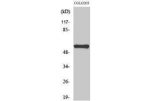 Western Blotting (WB) image for anti-Microphthalmia-Associated Transcription Factor (MITF) (Ser90) antibody (ABIN6281013) (MITF Antikörper  (Ser90))