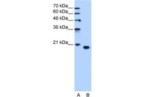 Western Blotting (WB) image for anti-Phosphatidylethanolamine Binding Protein 1 (PEBP1) antibody (ABIN2463157) (PEBP1 Antikörper)