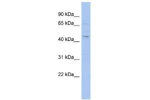 WB Suggested Anti-MGC33407 Antibody Titration: 0. (MGC33407 (Middle Region) Antikörper)