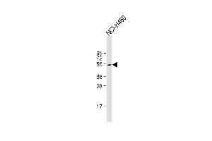 Anti-KRT36 Antibody (N-term) at 1:1000 dilution + NCI- whole cell lysate Lysates/proteins at 20 μg per lane. (Keratin 36 Antikörper  (N-Term))