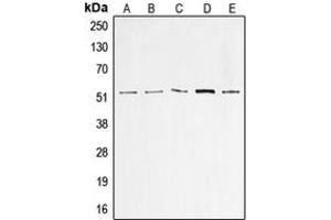 Western blot analysis of p53 expression in A549 (A), HeLa (B), HepG2 (C), MCF7 (D), A431 (E) whole cell lysates. (p53 Antikörper  (N-Term))