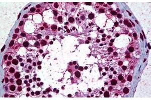 Human Testis: Formalin-Fixed, Paraffin-Embedded (FFPE) (Retinoblastoma Binding Protein 4 Antikörper  (AA 1-426))