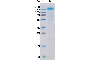 Human Her2 Protein, His Tag on SDS-PAGE under reducing condition. (ErbB2/Her2 Protein (AA 23-652) (His tag))