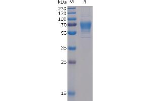 Human CD30 Ligand Protein, mFc-His Tag on SDS-PAGE under reducing condition. (TNFSF8 Protein (mFc-His Tag))