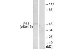 Western Blotting (WB) image for anti-Tumor Protein P53 (TP53) (pSer15) antibody (ABIN2888497) (p53 Antikörper  (pSer15))