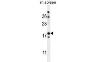 Western Blotting (WB) image for anti-Retinol Binding Protein 7, Cellular (RBP7) antibody (ABIN2999706) (RBP7 Antikörper)