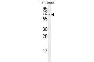 Western Blotting (WB) image for anti-F-Box Protein 21 (FBXO21) antibody (ABIN2996140) (FBXO21 Antikörper)