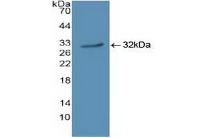 Detection of Recombinant JAK1, Human using Polyclonal Antibody to Janus Kinase 1 (JAK1) (JAK1 Antikörper  (AA 596-841))