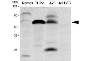 Western Blotting (WB) image for anti-Interferon Regulatory Factor 5 (IRF5) antibody (ABIN2475143) (IRF5 Antikörper)