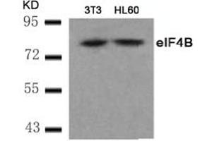 Image no. 2 for anti-Eukaryotic Translation Initiation Factor 4B (EIF4B) (AA 420-424) antibody (ABIN401569) (EIF4B Antikörper  (AA 420-424))