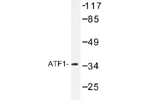 Image no. 1 for anti-Activating Transcription Factor 1 (AFT1) antibody (ABIN272179) (AFT1 Antikörper)