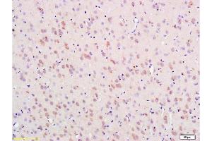 Formalin-fixed and paraffin embedded rat brain labeled with Anti-Nestin Polyclonal Antibody , Unconjugated 1:300 followed by conjugation to the secondary antibody and DAB staining (Nestin Antikörper  (AA 681-750))