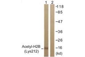 Western Blotting (WB) image for anti-Histone H2B (acLys12) antibody (ABIN2890727) (Histone H2B Antikörper  (acLys12))