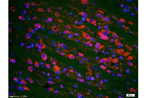 Formalin-fixed and paraffin-embedded rat brain labeled with Anti-phospho-P53(Ser20) Polyclonal Antibody, Unconjugated (ABIN702895) 1:200, overnight at 4°C, The secondary antibody was Goat Anti-Rabbit IgG, Cy3 conjugated used at 1:200 dilution for 40 minutes at 37°C. (p53 Antikörper  (pSer20))