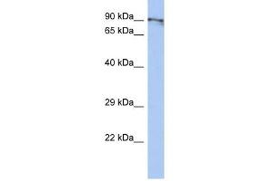 CXORF20 antibody used at 1 ug/ml to detect target protein. (BEND2 Antikörper  (Middle Region))