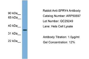 WB Suggested Anti-SPRY4  Antibody Titration: 0. (SPRY4 Antikörper  (Middle Region))