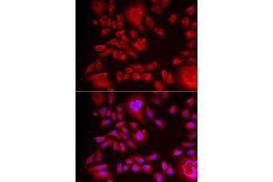 Immunofluorescence analysis of HeLa cell using BLMH antibody. (BLMH Antikörper)