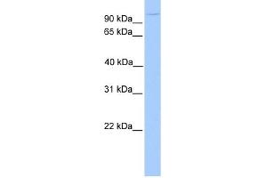 NUP98 antibody used at 1 ug/ml to detect target protein. (NUP98 Antikörper  (N-Term))