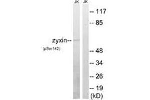 Western blot analysis of extracts from Jurkat cells treated with paclitaxel 1uM 24h, using Zyxin (Phospho-Ser142) Antibody. (ZYX Antikörper  (pSer142))