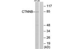 Western blot analysis of extracts from HT-29 cells, treated with Forskolin, using Catenin-beta (Ab-37) Antibody. (beta Catenin Antikörper  (AA 3-52))
