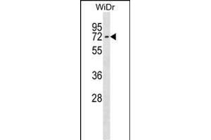 CTNNBL1 Antibody (N-term) (ABIN1539081 and ABIN2848704) western blot analysis in WiDr cell line lysates (35 μg/lane). (CTNNBL1 Antikörper  (N-Term))