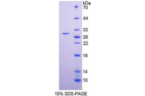 SLC12A7 Protein (AA 845-1056) (T7 tag,His tag)