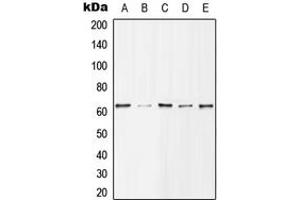 Western blot analysis of Histone Deacetylase 1 (pS421) expression in MCF7 EGF-treated (A), Jurkat (B), NIH3T3 (C), mouse spleen (D), H9C2 EGF-treated (E) whole cell lysates. (HDAC1 Antikörper  (C-Term, pSer421))
