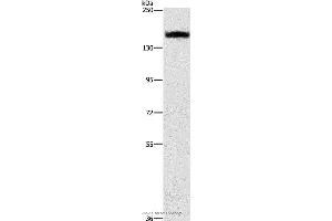 Western blot analysis of A431 cell, using ITGA2 Polyclonal Antibody at dilution of 1:300 (ITGA2 Antikörper)