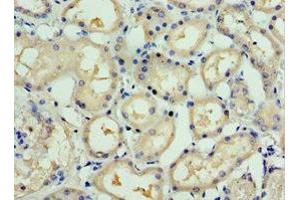 Immunohistochemistry of paraffin-embedded human kidney tissue using ABIN7166165 at dilution of 1:100 (SSX5 Antikörper  (AA 1-229))