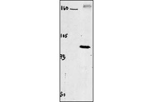 Western blot of chicken brain tissue incubated with CLC4 Antibody . (CLCN4 Antikörper  (C-Term))