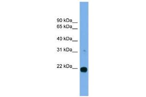 WB Suggested Anti-MITD1 Antibody Titration: 0. (MITD1 Antikörper  (Middle Region))