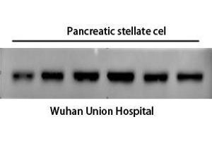 Western Blot (WB) analysis: Please contact us for more details. (alpha-SMA Antikörper)