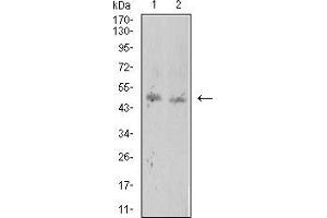 Western Blotting (WB) image for anti-ROP1 (AA 42-183) antibody (ABIN5869166) (ROP1 (AA 42-183) Antikörper)