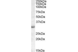 Western Blotting (WB) image for anti-RAB23, Member RAS Oncogene Family (RAB23) (C-Term) antibody (ABIN2466733) (RAB23 Antikörper  (C-Term))